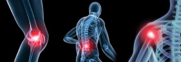 Types of pain with arthrosis