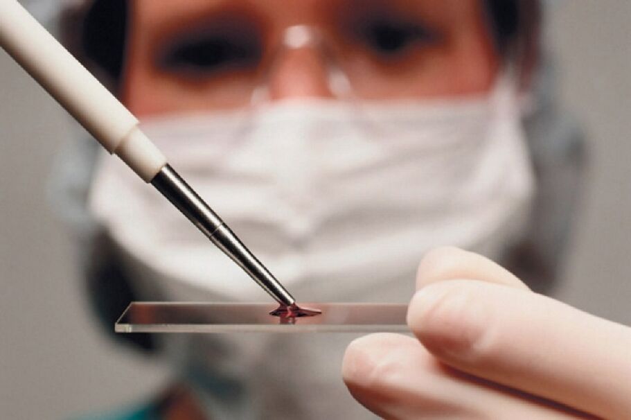 Arthritis is an inflammatory disease, and its presence is revealed by blood tests.
